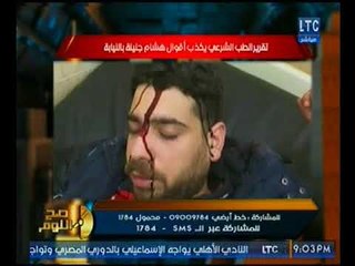 تقرير الطب الشرعي يكشف مفاجأه في إدعاءات المستشار هشام جنينه