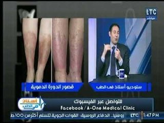استاذ فى الطب | مع شيرين سيف النصر ود. عادل الفرجاني حول علاج أصعب الالام بـ جهاز الاوزون 4-2-2018