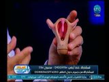 برنامج استاذ في الطب | مع شيري صالح ود.خالد عبد الملك حول مشاكل تأخر الإنجاب-27-3-2018