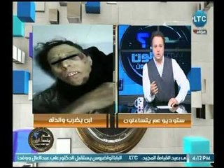 بالصور ..احمد عبدو ن يعرض جريمة انسانية بشعة لـ ابن لا يعرف الرحمة عاقب والدته بالضرب لهذا السبب