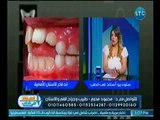 استاذ في الطب | مع د. محمود محرم حول تصحيح مفاهيم خاطئه  ونصائح لنظافة الفم والاسنان 14-5-2018