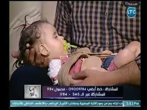دنيا تانية - ام تروي مأساة ابنتها عالهواء أصيبت بمرض نادر جدا وتحتاج لعلاج حقن بـ مليون دولار