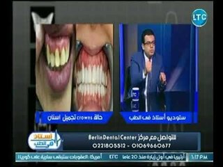برنامج استاذ فى الطب | مع غادة حشمت ود. الحسن دياب حول " زراعة و تجميل الأسنان "  8-7-2018