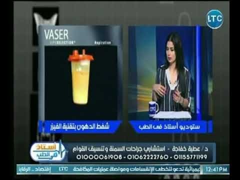 استشاري جراحات السمنة يوضح بالفيديو كيف يتم شفط الدهون بتقنية الفيزر