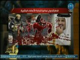 صح النوم - محمد الغيطي يفتح النار على يوسف القرضاوي: شيخ حقير خرف