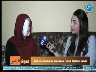 كغيرها من الفتيات "منار" تحلم بارتداء فستان الزفاف ففوجئت بابن عمها يشوه وجهه بـ 40 غرزة والسبب صادم