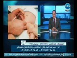 استاذ في الطب | مع أ.د احمد عبد الغفار هلال حول الطهاره عند الاطفال 9-11-2018
