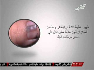 " بالطو أبيض " ... أمراضك تبدأ من أظافرك