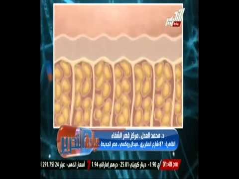 عيادة التحرير - الحل السحرى الغير مكلف لعلاج السلولويد وخشونة الركبة والمفاصل