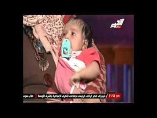 برنامج بصراحة - يعرض حالات إنسانية تعرضت للإهمال طبى - 21 سبتمبر 2014