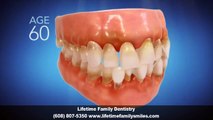 Invisalign Dentist Fitchburg WI