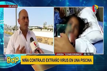 Ameba “come cerebros”: niña habría contraído extraño virus en piscina