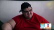 Joven con obesidad mórbida ¡baja 300 kilos! | Noticias con Francisco Zea