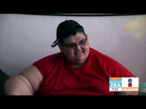 Joven con obesidad mórbida ¡baja 300 kilos! | Noticias con Francisco Zea