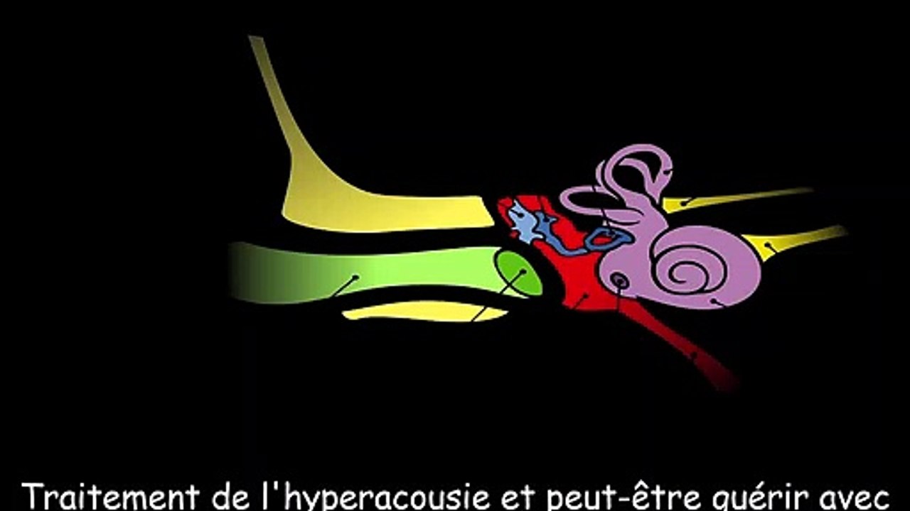 Traitement de l'hyperacousie et peut-être guérir avec la fréquence sonore (enrichissement sonore) - une heure