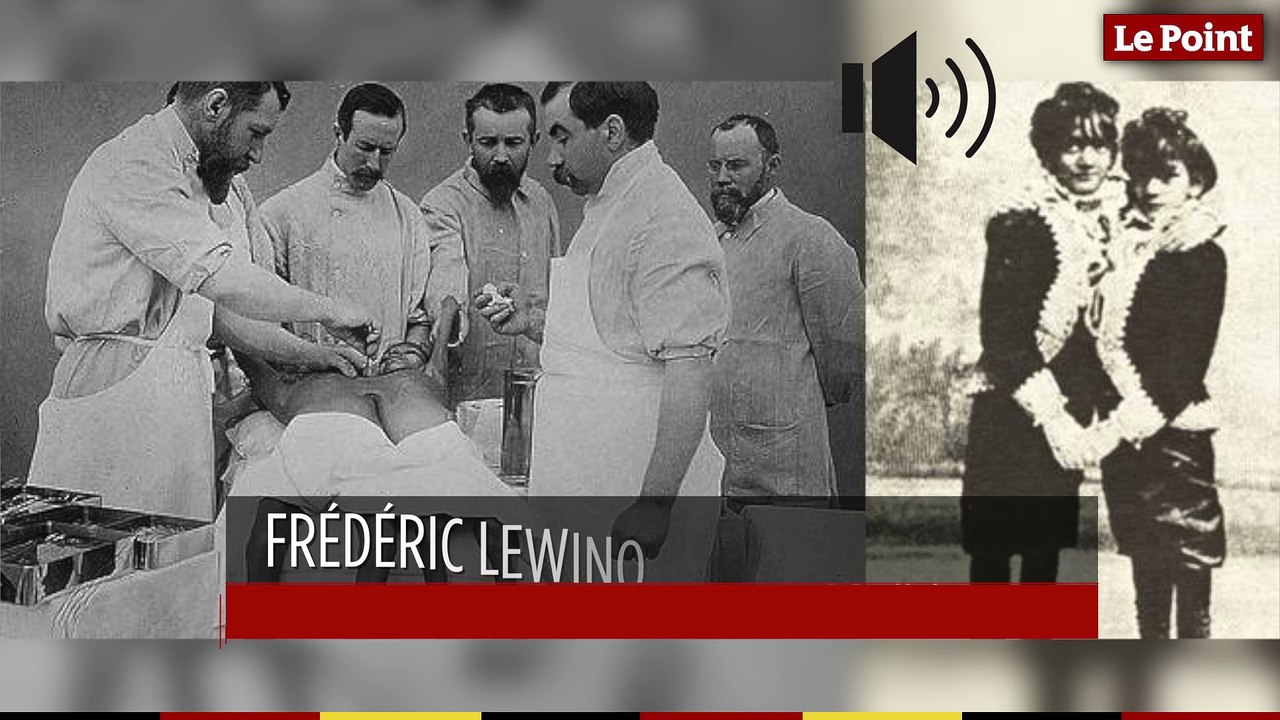 9 février 1902 : le jour où les deux soeurs siamoises Doodica et Radica sont séparées