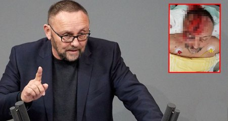 Almanya'da Milletvekili Frank Magnitz, 3 Zanlının Saldırısına Uğradıktan Sonra Ölüme Terk Edildi