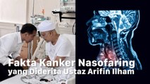Deretan Fakta Kanker Nasofaring yang Menyerang Ustaz Arifin Ilham