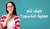 كيف تتم عملية الناسور؟