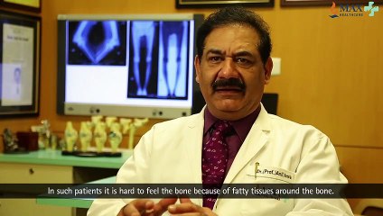 Life changing Knee Replacement Iraq Patient PINLESS Computer Navigation Technology