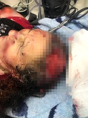 Kırşehir'de Köpeklerin Saldırdığı Kadın Ağır Yaralandı