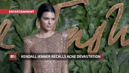 Kendall Jenner Had Devastating Acne Breakouts As A Teenager