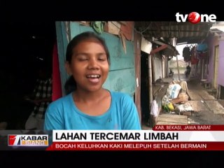 Diduga Lahan Tercemar Limbah, 3 Bocah Terluka saat Bermain