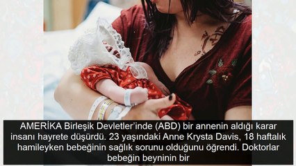 Bebeğini organları için doğurdu bu anne alkışlanır