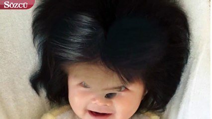 Saçları doğuştan şans getirdi