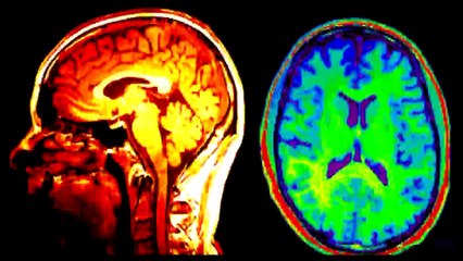 Substância tóxica no seu creme dental/Água - Flúor