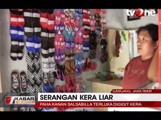 Kelaparan, Kawanan Kera Turun ke Pemukiman Serang 4 Balita