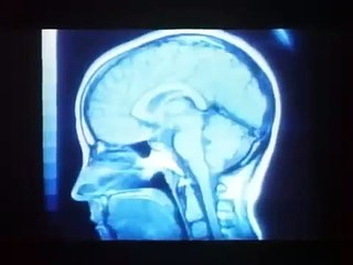 BRAIN DEAD (1990) Official Trailer