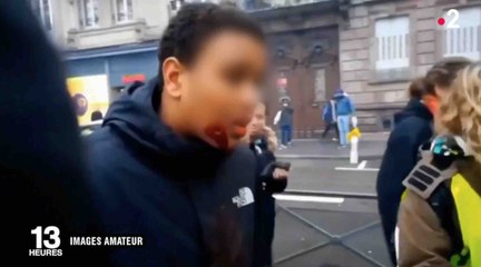 «Gilets jaunes» à Strasbourg: Un adolescent blessé au visage - ZAPPING ACTU DU 14/01/2019
