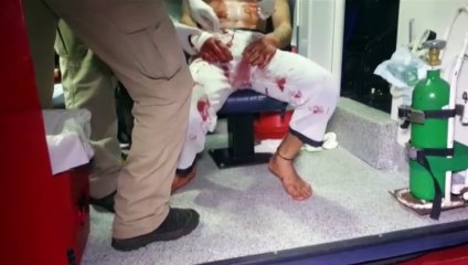 Jovem é socorrido após sofrer corte no braço