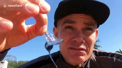 Aussie stings himself with Man O’War jellyfish to challenge his pain threshold