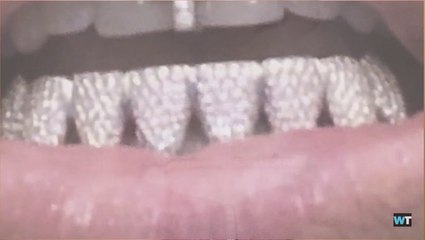 The Full History Of Grillz In The Mainstream Popular Culture