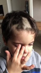 Cet enfant s'est rasé une partie du crâne tout seul, pour égaliser la coupe !