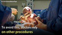 [CH] Odon Device, el facilitador de partos que podría salvar miles de vidas