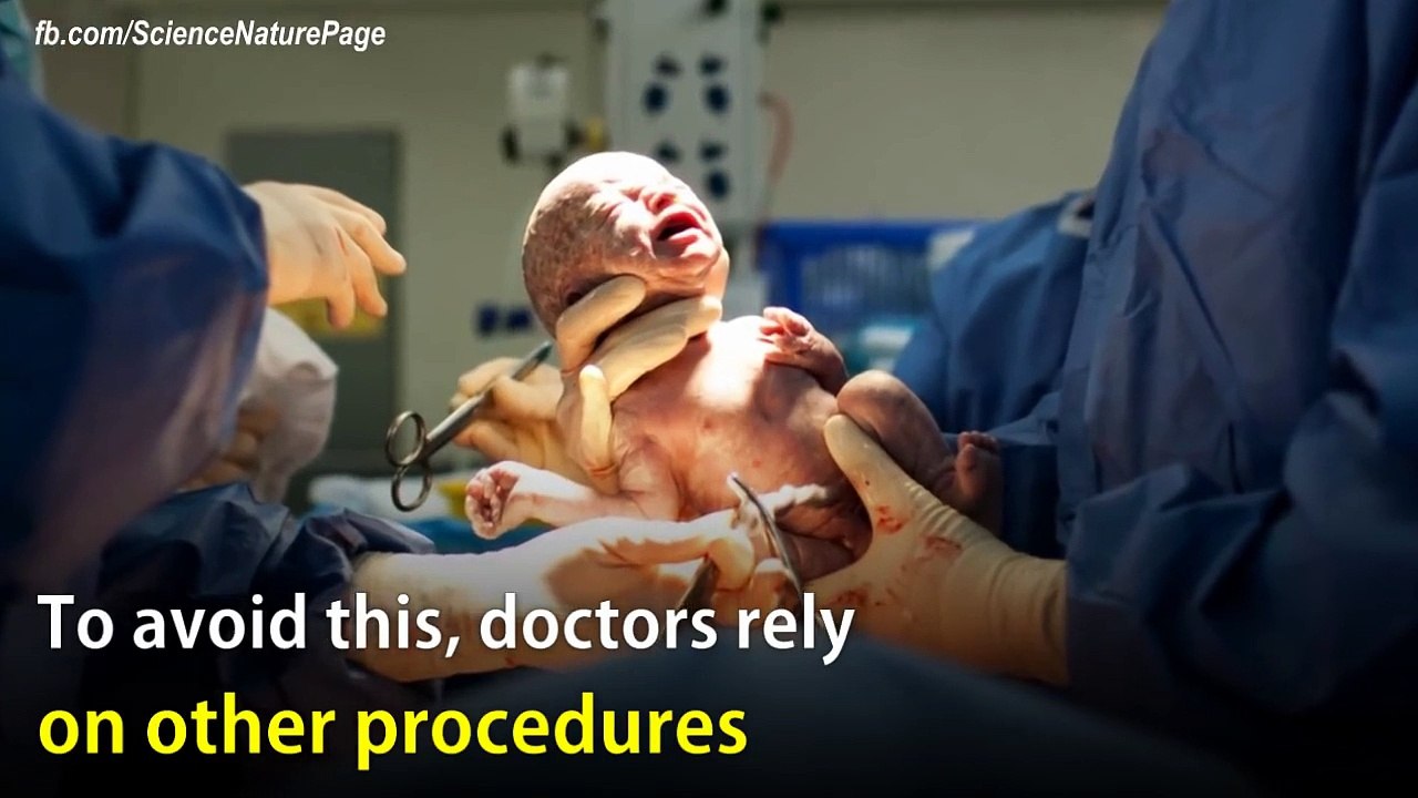 [CH] Odon Device, el facilitador de partos que podría salvar miles de vidas