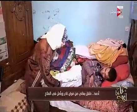 شاهد.. كل يوم يعرض تقريراً حول طفل يعانى من مرض نادر ويأمل فى العلاج