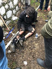 Üniversite Öğrencisi Köpek Saldırısıyla Yaralandı