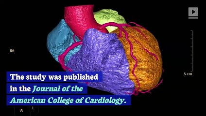 Too Little Sleep May Boost Your Risk of Cardiovascular Disease, Says Study