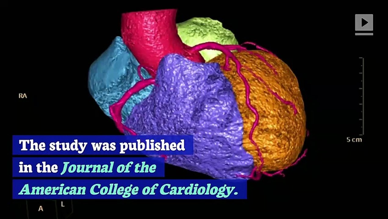 Too Little Sleep May Boost Your Risk of Cardiovascular Disease, Says Study