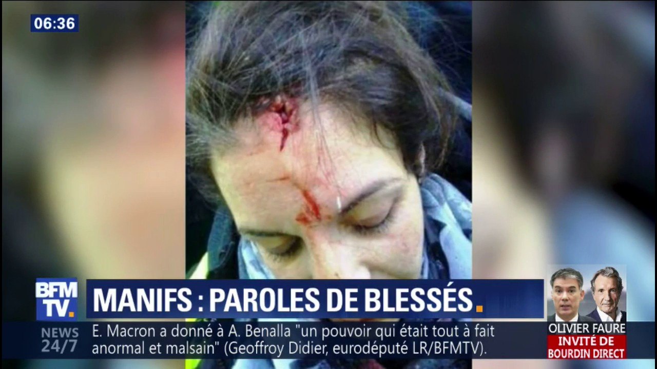 "Il faut qu'ils aient conscience de ce qu'ils font." Blessés par des tirs de LBD, ils témoignent