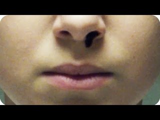 Stranger Things Season 2 Nosebleed Viral Video (2017) Netflix Series