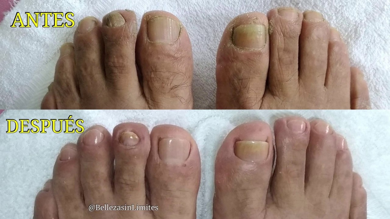 Estética Masculina |  Manicura y Pedicura para Hombres  by Belleza sin Limites