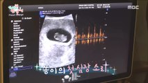 [HOT]hear the baby's heart,전지적 참견 시점 20190119