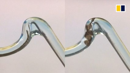 ‘Microswimmer’ robots to the rescue