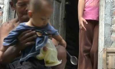 Lahir Tanpa Anus, Bocah Sulit Biaya Kantong Kolostomi