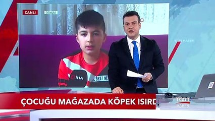 Çocuğu Mağazada Köpek Isırdı